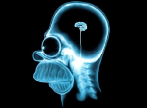 Expert homer-simpson-radiografia-cerebro