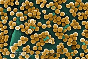 Herbal Antibiotics Germs