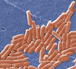 Digestive Salmonella, Public Domain, CDC image