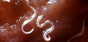 Tropical Disease Hookworm-Post