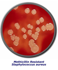 Surviving MRSA mrsa_plate