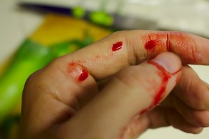 bleeding accident-743036_640