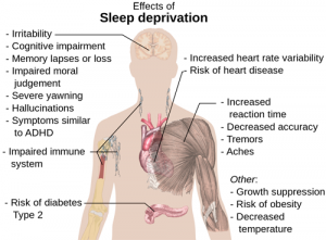 5 Tips to Prevent Sleep Deprivation