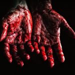 Sepsis – Blood Poisoning Fast Lane to Death